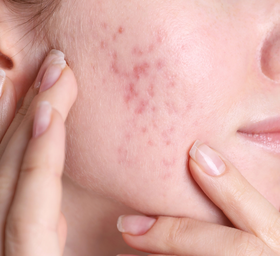 Treatment Image